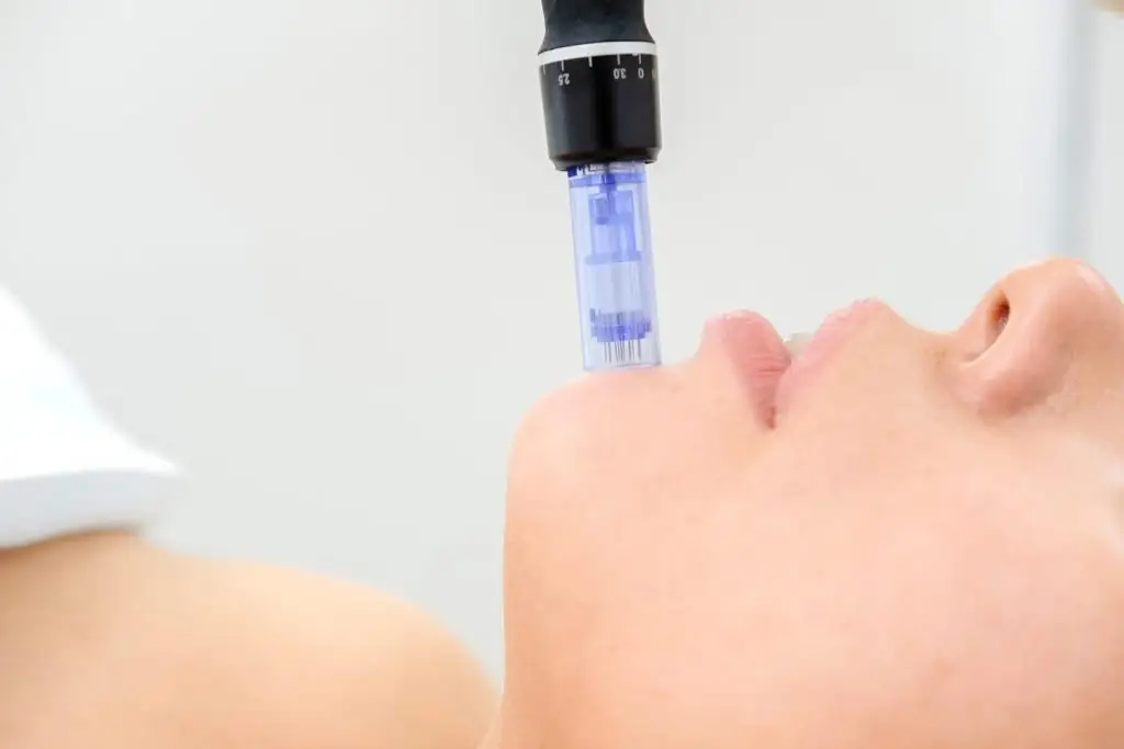 microneedle therapy