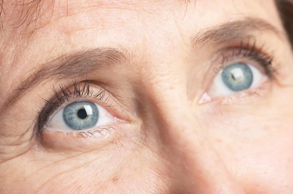 crows feet