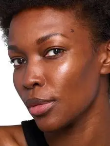 after skinvive treatment